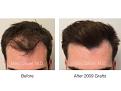 Click image for larger version

Name:	2009 FUT.001.jpg
Views:	401
Size:	11.6 KB
ID:	482708