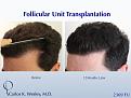 Click image for larger version

Name:	Slide2.jpg
Views:	625
Size:	79.1 KB
ID:	482767
