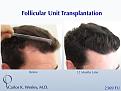 Click image for larger version

Name:	Slide1.jpg
Views:	673
Size:	78.3 KB
ID:	482768