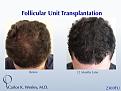 Click image for larger version

Name:	Slide3.jpg
Views:	603
Size:	82.4 KB
ID:	482769