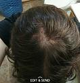 Click image for larger version

Name:	PhotoGrid_1497122034488.jpg
Views:	16028
Size:	15.4 KB
ID:	482867