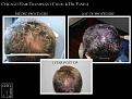 Click image for larger version

Name:	Slide5.JPG
Views:	295
Size:	79.9 KB
ID:	482975