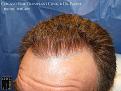 Click image for larger version

Name:	Slide7.JPG
Views:	293
Size:	91.5 KB
ID:	482977