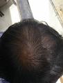 Click image for larger version

Name:	IMG_20170621_100201.jpg
Views:	396
Size:	96.8 KB
ID:	483053