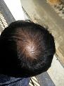 Click image for larger version

Name:	IMG_20170621_100208.jpg
Views:	419
Size:	94.4 KB
ID:	483055