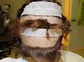 Click image for larger version

Name:	br before donor shaved.jpg
Views:	283
Size:	95.3 KB
ID:	483088