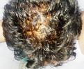 Click image for larger version

Name:	3. MID SCALP.jpg
Views:	128
Size:	89.5 KB
ID:	483132