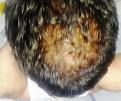 Click image for larger version

Name:	2. CROWN.jpg
Views:	193
Size:	81.3 KB
ID:	483139