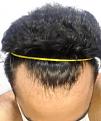 Click image for larger version

Name:	7.HAIRLINE.jpg
Views:	198
Size:	70.5 KB
ID:	483144