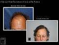 Click image for larger version

Name:	Slide1.JPG
Views:	215
Size:	82.9 KB
ID:	483294
