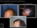 Click image for larger version

Name:	Slide4.jpg
Views:	215
Size:	64.8 KB
ID:	483297
