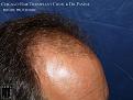 Click image for larger version

Name:	Slide10.jpg
Views:	196
Size:	89.6 KB
ID:	483303
