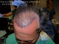 Click image for larger version

Name:	Slide14.jpg
Views:	210
Size:	80.7 KB
ID:	483307