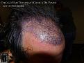 Click image for larger version

Name:	Slide16.jpg
Views:	214
Size:	82.1 KB
ID:	483309