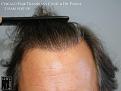 Click image for larger version

Name:	Slide19.jpg
Views:	216
Size:	54.4 KB
ID:	483312