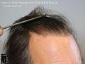Click image for larger version

Name:	Slide25.jpg
Views:	221
Size:	69.5 KB
ID:	483323