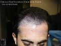 Click image for larger version

Name:	Slide12.jpg
Views:	231
Size:	64.1 KB
ID:	483530