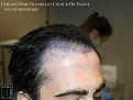 Click image for larger version

Name:	Slide14.jpg
Views:	224
Size:	67.1 KB
ID:	483532