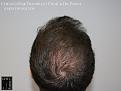 Click image for larger version

Name:	Slide23.jpg
Views:	226
Size:	59.1 KB
ID:	483541