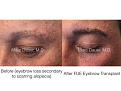 Click image for larger version

Name:	4 pts keyslidesET FUE.003.jpg
Views:	273
Size:	14.0 KB
ID:	483545