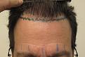 Click image for larger version

Name:	Before Photos 12 8 2016002.jpg
Views:	226
Size:	95.3 KB
ID:	483546