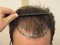 Click image for larger version

Name:	Before Photos 12 8 2016003.jpg
Views:	234
Size:	90.5 KB
ID:	483548