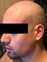 Click image for larger version

Name:	Before.jpg
Views:	1177
Size:	75.4 KB
ID:	483556