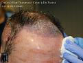 Click image for larger version

Name:	Slide12.jpg
Views:	235
Size:	77.5 KB
ID:	483762