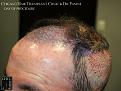 Click image for larger version

Name:	Slide13.jpg
Views:	241
Size:	74.4 KB
ID:	483763
