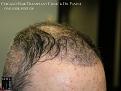 Click image for larger version

Name:	Slide17.jpg
Views:	239
Size:	68.8 KB
ID:	483767