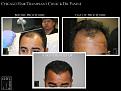 Click image for larger version

Name:	Slide2.jpg
Views:	205
Size:	62.5 KB
ID:	483865