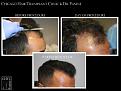 Click image for larger version

Name:	Slide3.jpg
Views:	205
Size:	65.6 KB
ID:	483866