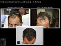 Click image for larger version

Name:	Slide5.jpg
Views:	206
Size:	64.5 KB
ID:	483868