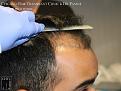 Click image for larger version

Name:	Slide9.jpg
Views:	211
Size:	72.7 KB
ID:	483872