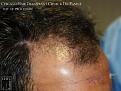 Click image for larger version

Name:	Slide11.jpg
Views:	207
Size:	76.9 KB
ID:	483874