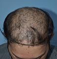 Click image for larger version

Name:	Darling Buds Clinic India (10).jpg
Views:	286
Size:	85.5 KB
ID:	483928