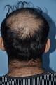 Click image for larger version

Name:	Darling Buds Clinic India (11).jpg
Views:	294
Size:	95.7 KB
ID:	483929