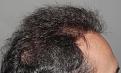 Click image for larger version

Name:	.4 years post R profile.jpg
Views:	289
Size:	98.3 KB
ID:	484012