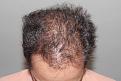 Click image for larger version

Name:	.4 years post chin down.jpg
Views:	310
Size:	95.4 KB
ID:	484013