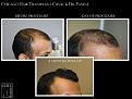 Click image for larger version

Name:	Slide3.jpg
Views:	314
Size:	60.3 KB
ID:	484299