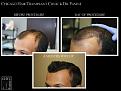 Click image for larger version

Name:	Slide4.jpg
Views:	316
Size:	62.7 KB
ID:	484300