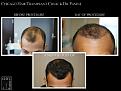 Click image for larger version

Name:	Slide5.JPG
Views:	314
Size:	97.2 KB
ID:	484301