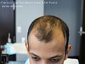 Click image for larger version

Name:	Slide7.jpg
Views:	306
Size:	55.4 KB
ID:	484303