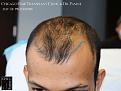 Click image for larger version

Name:	Slide10.jpg
Views:	300
Size:	62.0 KB
ID:	484306