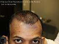 Click image for larger version

Name:	Slide11.jpg
Views:	306
Size:	61.0 KB
ID:	484307