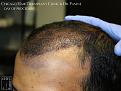 Click image for larger version

Name:	Slide12.jpg
Views:	315
Size:	82.4 KB
ID:	484308