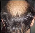Click image for larger version

Name:	Back_Hair.jpg
Views:	452
Size:	17.0 KB
ID:	485626