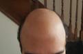 Click image for larger version

Name:	Front_Hair.jpg
Views:	442
Size:	8.1 KB
ID:	485627
