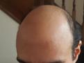 Click image for larger version

Name:	front_Hair2.jpg
Views:	438
Size:	7.2 KB
ID:	485628