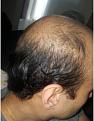 Click image for larger version

Name:	Right_Side.jpg
Views:	416
Size:	10.5 KB
ID:	485630